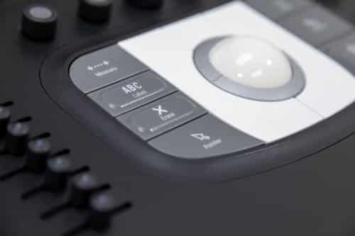 Epiq 5 ultrasound