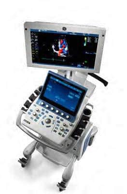 GE VIvid S60 Top View