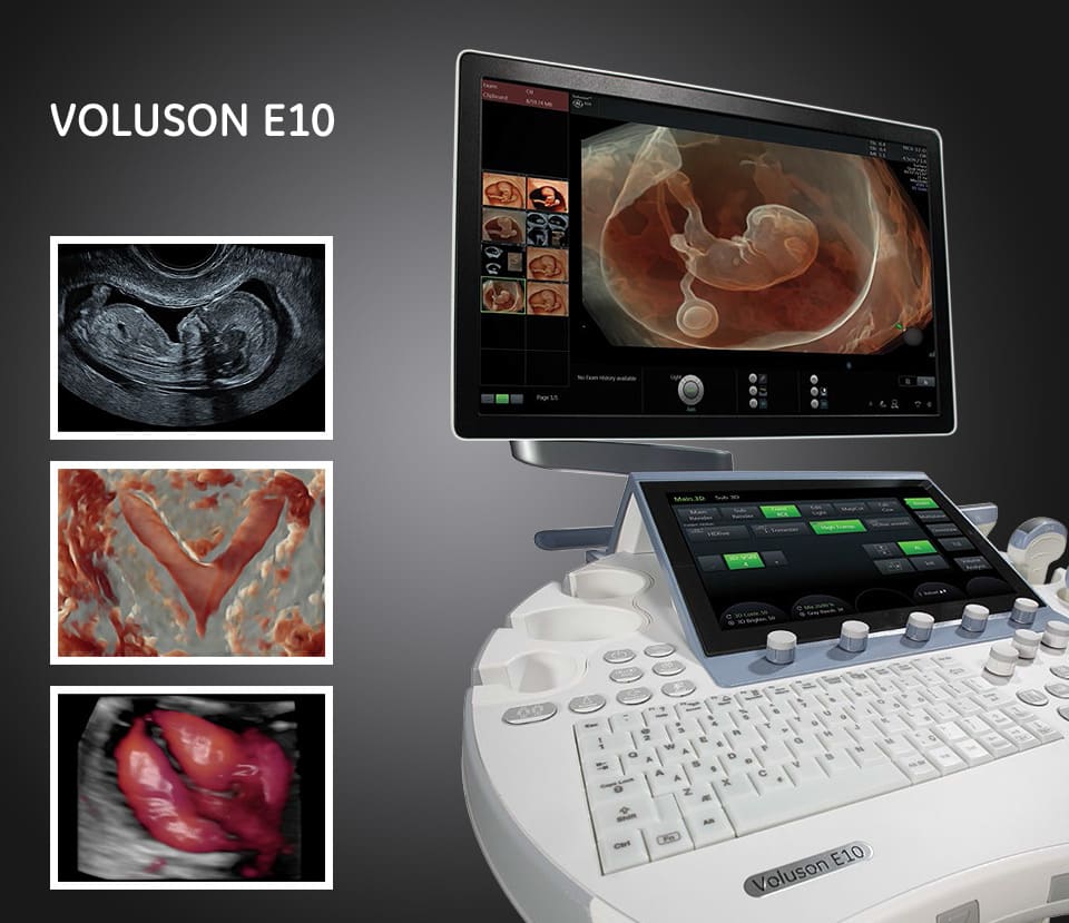 ge voluson e10
