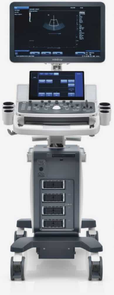 Mindray DC-70 ultrasound