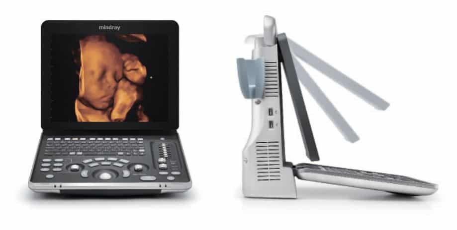 Mindray Z60 price