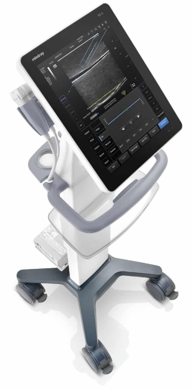refurbished Mindray TE5