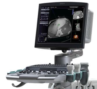 Acuson S3000 - Image 2