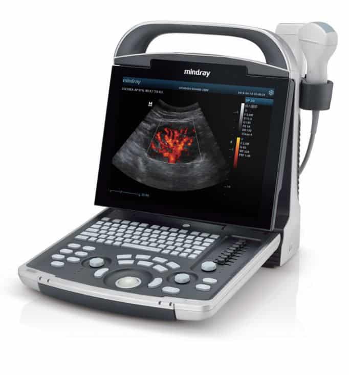 refurbished mindray dp-30