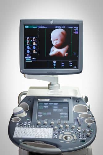GE Voluson E8 - Image 5