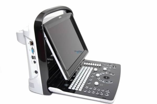 Chison eco3 Chison ECO3 Ultrasound