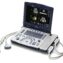 GE Logiq V2 portable Ultrasound Machine
