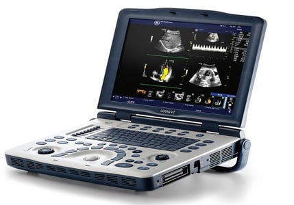 GE Logiq V2 portable ultrasound for urology GE Logiq V2 portable ultrasound for urology