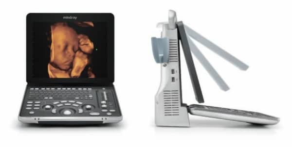 Mindray Z60 price Mindray Z60 price