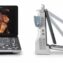 Mindray Z60 price