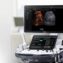 Samsung Medison RS80A Ultrasound Machine