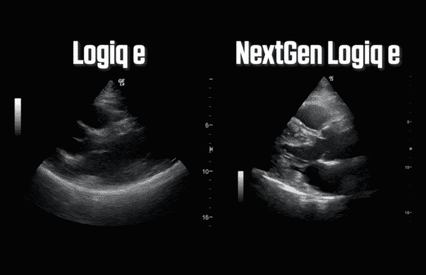 nextgen GE nextgen logiq e