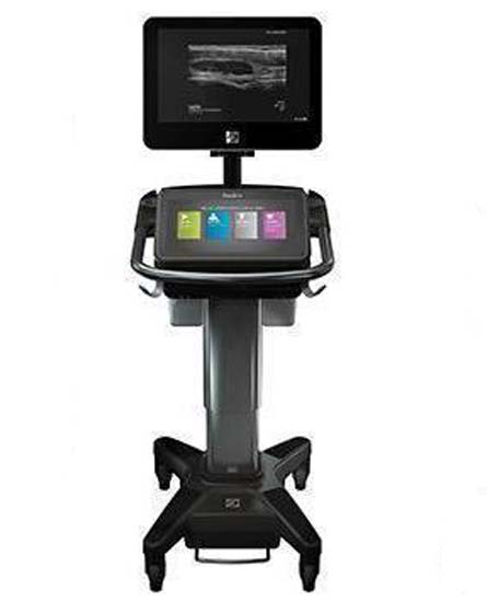 sonosite x-porte sonosite x-porte for sale