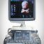 voluson e8 ultrasound