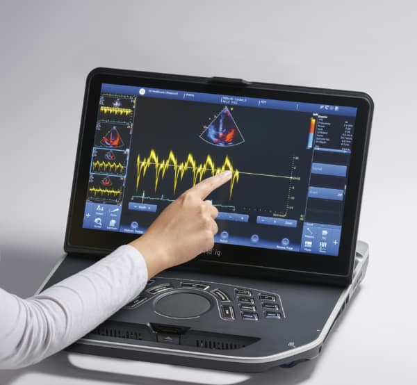 GE Vivid iq Portable Color Doppler Ultrasound Machine