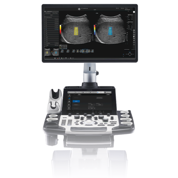 GE Logiq Fortis Ultrasound GE Logiq Fortis Ultrasound