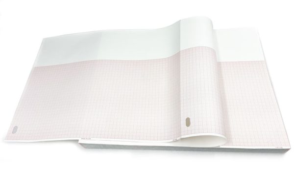 philipsECG-paper2-1