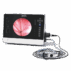 Aohua-OR-100-endoscopy-system-for-sale