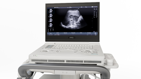 LOGIQ_e_TGE Healthcare LOGIQ e R9P_012 GE Healthcare LOGIQ e R9