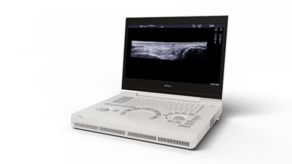 GE Healthcare LOGIQ e R9 GE Healthcare LOGIQ e R9