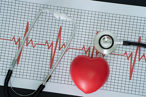 cardiovascular equipment for sale